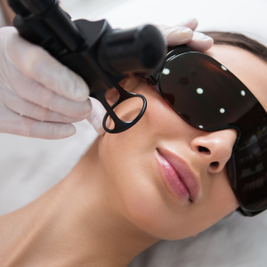 How Laser Treatments Transform Your Skin