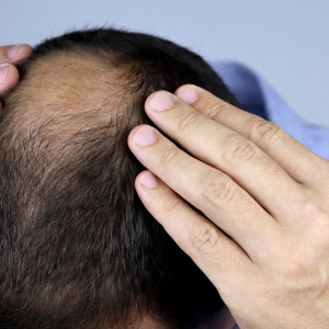 Men’s Haircare: Simple Tips for Healthy, Strong Hair